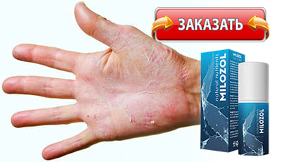 Milozol купить в аптеке.